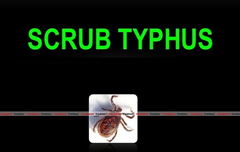 scrub typhus