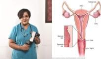 Nagpur Gynaecologist Develops Affordable Cervical Cancer Screening Device, Receives Patent