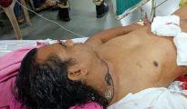 Knife blade stuck in man’s abdomen after attacked by goons in Imambada