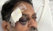 Cong leader Nitin Raut injured during Yatra