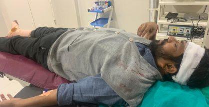 MLA Bacchu Kadu meets with mishap while crossing road in Amravati