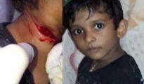 11-year-old boy dies after Nylon Manja slits his throat in Nagpur