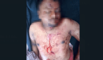 गोंदिया: ड्रग्स की सप्लाई करने वाले दो गुटों के बीच आपसी रंजिश , युवक की दिनदहाड़े हत्या