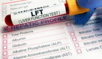 These Tests Can Reveal if Your Liver is Functioning Normally