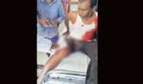 Man injured in tiger attack, 2nd attack in last 48 hours in Nagpur district