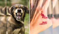 Rising Dog Menace Claims 5,000 Lives in Eight Months