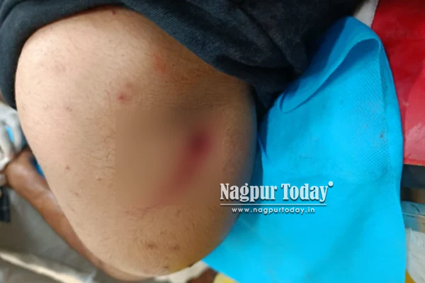 नागपुर: गणेशपेठ में युवक की हत्या, मोपेड से टक्कर मारकर तीन दोस्तों पर किया हमला
