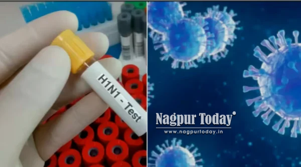 Swine flu cases double in Nagpur amid surge in seasonal infections