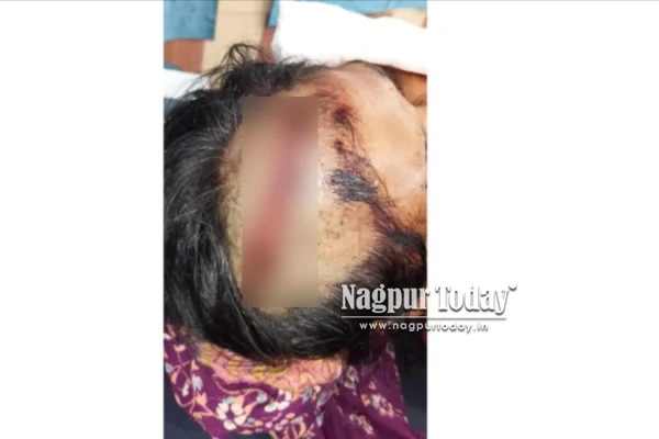 Nagpur woman attacked with iron saw, neighbour held