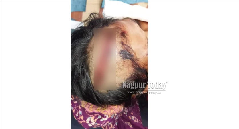 Nagpur woman attacked with iron saw, neighbour held
