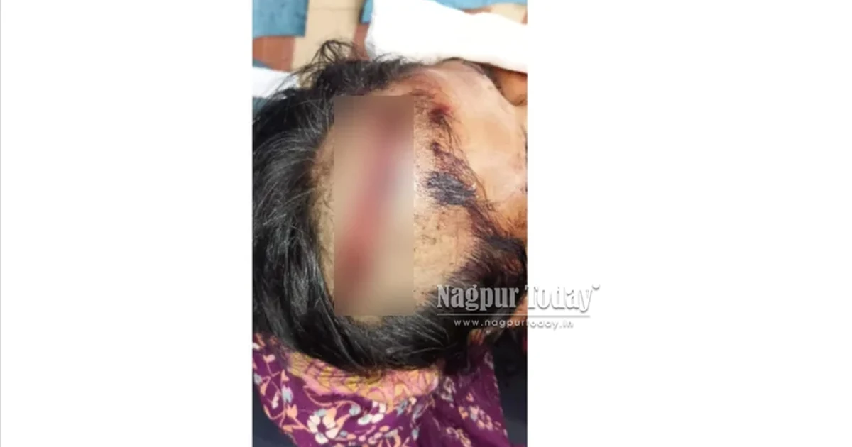 Nagpur woman attacked with iron saw, neighbour held