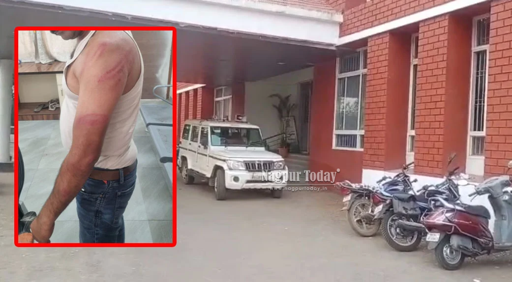 अवैध शराब बेचने के आरोपी ने पुलिसकर्मी पर किया हमला, उंगली में गंभीर चोट