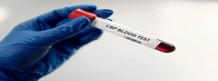What Is a CBP Test? A Complete Guide to Its Importance and Uses